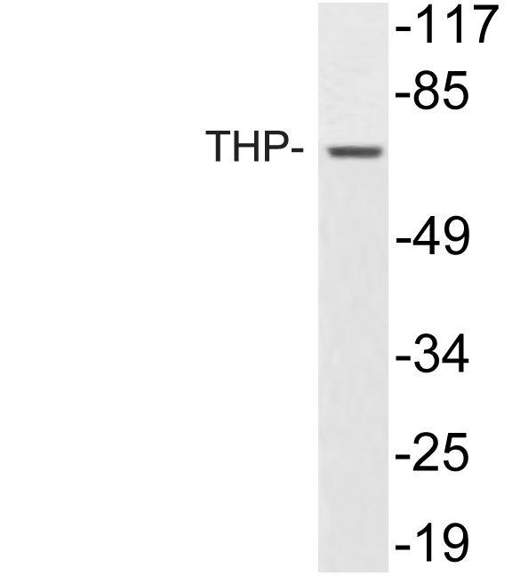 UMOD / Uromodulin Antibody - Western blot of UMOD (V378) pAb in extracts from K562 cells.