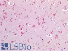 USP19 Antibody - Human Brain, Cortex: Formalin-Fixed, Paraffin-Embedded (FFPE)