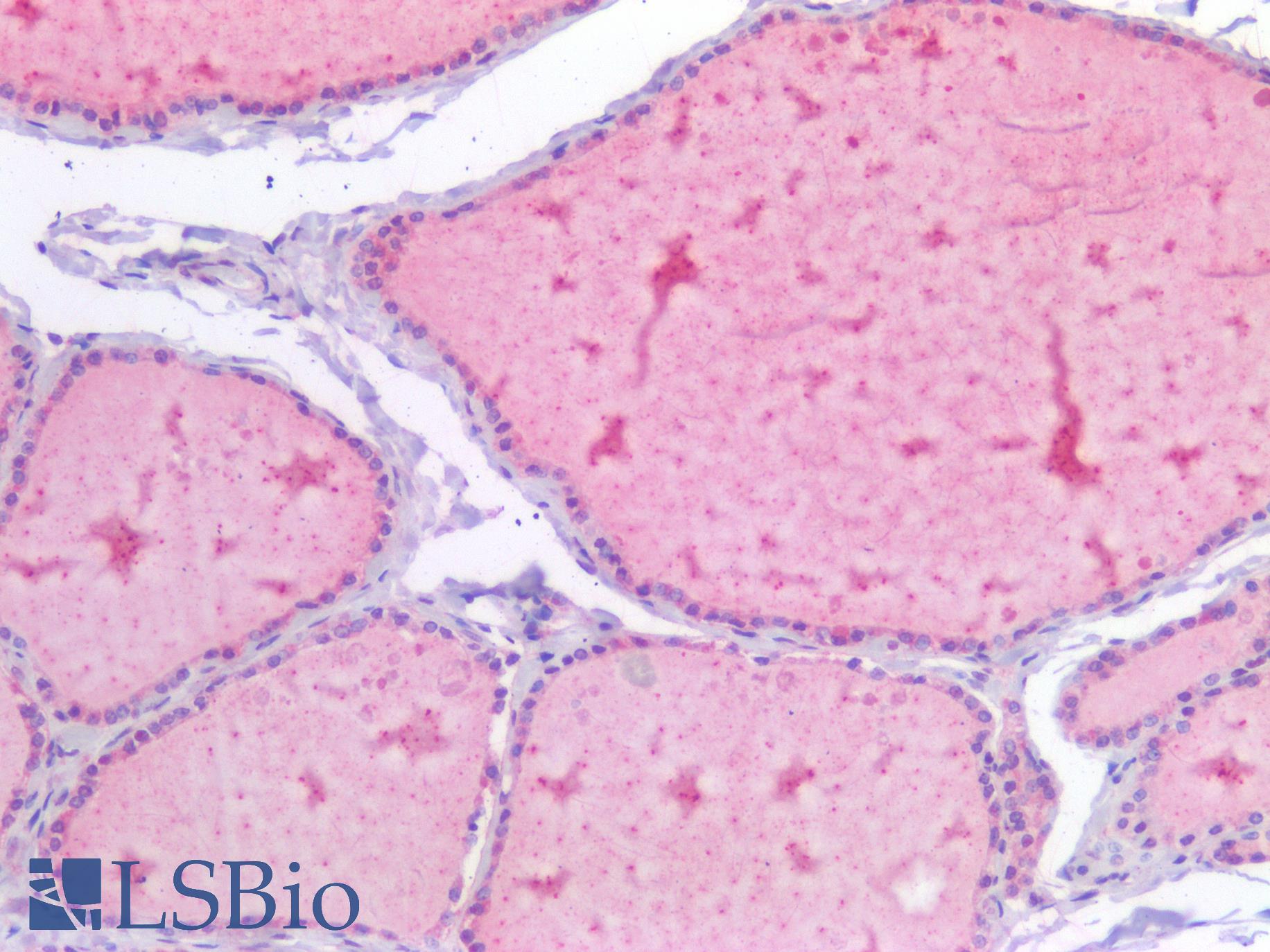 USP19 Antibody - Human Thyroid: Formalin-Fixed, Paraffin-Embedded (FFPE)