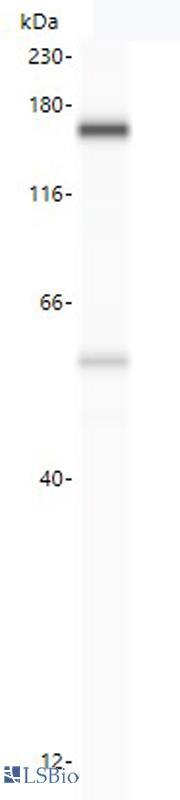 USP19 Antibody - Anti-USP19 antibody (LS-A10984, 100 µg/mL) yields a specific band on capillary Western analysis (Protein Simple, WES 12-230 kDa separation module) in 250 ?g human ATG16L1 overexpression lysate. 