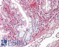 VEGFC Antibody - Anti-VEGFC antibody IHC staining of human small intestine. Immunohistochemistry of formalin-fixed, paraffin-embedded tissue after heat-induced antigen retrieval. Antibody dilution 1:50.