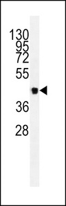 VEGFC Antibody - Western blot of lysates from 293, CEM cell line and mouse heart, rat heart tissue lysates (from left to right), using VEGFC Antibody. Antibody was diluted at 1:1000 at each lane. A goat anti-mouse IgG H&L (HRP) at 1:3000 dilution was used as the secondary antibody. Lysates at 35ug per lane.