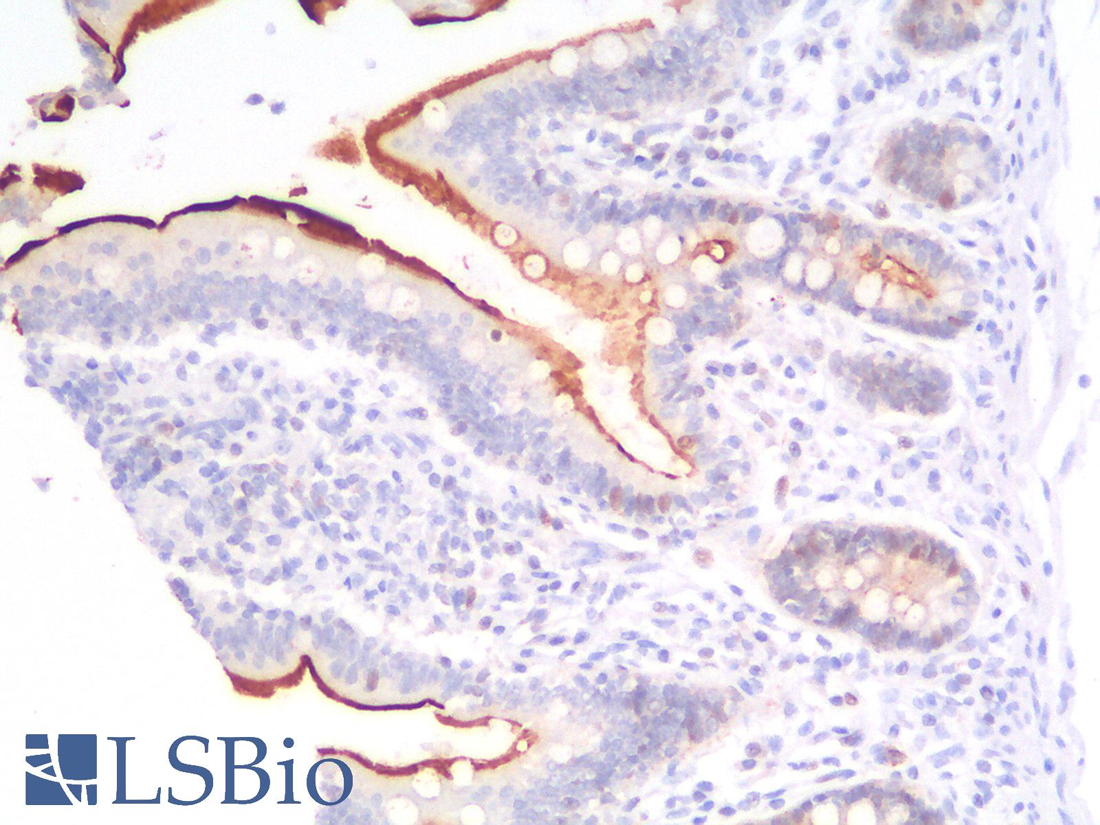 VIL1 / Villin Antibody - Human Smal Intestine: Formalin-Fixed, Paraffin-Embedded (FFPE)