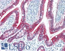VIL1 / Villin Antibody - Human Small Intestine: Formalin-Fixed, Paraffin-Embedded (FFPE)