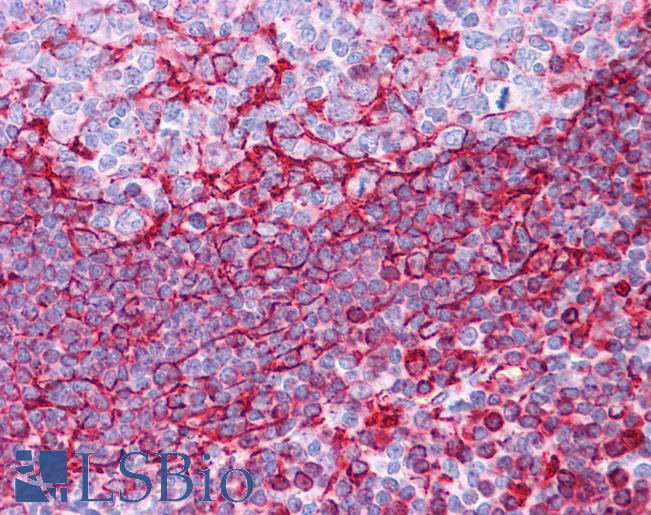 Vimentin Antibody - Anti-Vimentin antibody IHC of human tonsil. Immunohistochemistry of formalin-fixed, paraffin-embedded tissue after heat-induced antigen retrieval. Antibody concentration 5 ug/ml.  This image was taken for the unconjugated form of this product. Other forms have not been tested.