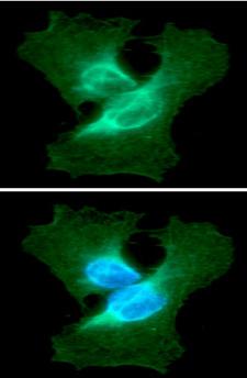 Vimentin Antibody - ICC/IF analysis of VIM in HeLa cells line, stained with DAPI (Blue) for nucleus staining and monoclonal anti-human VIM antibody (1:100) with goat anti-mouse IgG-Alexa fluor 488 conjugate (Green).