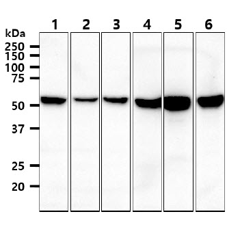 Vimentin Antibody - The cell lysates (40ug) were resolved by SDS-PAGE, transferred to PVDF membrane and probed with anti-human VIM antibody (1:1000). Proteins were visualized using a goat anti-mouse secondary antibody conjugated to HRP and an ECL detection system. Lane 1 : Jurkat cell lysate Lane 2 : K562 cell lysate Lane 3 : 293T cell lysate Lane 4 : A549 cell lysate Lane 5 : SK-OV-3 cell lysate Lane 6 : HeLa cell lysate