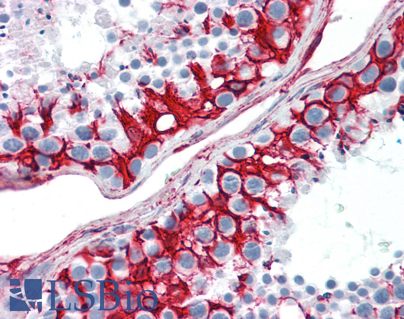 Vimentin Antibody - Human Testis: Formalin-Fixed, Paraffin-Embedded (FFPE)