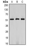 Vimentin Antibody - Western blot analysis of Vimentin expression in HeLa (A); mouse brain (B); rat brain (C) whole cell lysates.