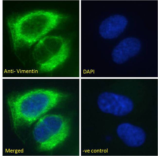 Vimentin Antibody - Vimentin antibody immunofluorescence analysis of paraformaldehyde fixed U2OS cells, permeabilized with 0.15% Triton. Primary incubation 1hr (5ug/ml) followed by Alexa Fluor 488 secondary antibody (2ug/ml), showing cytoplasmic/Intermediate filament staining. The nuclear stain is DAPI (blue). Negative control: Unimmunized goat IgG (5ug/ml) followed by Alexa Fluor 488 secondary antibody (2ug/ml).