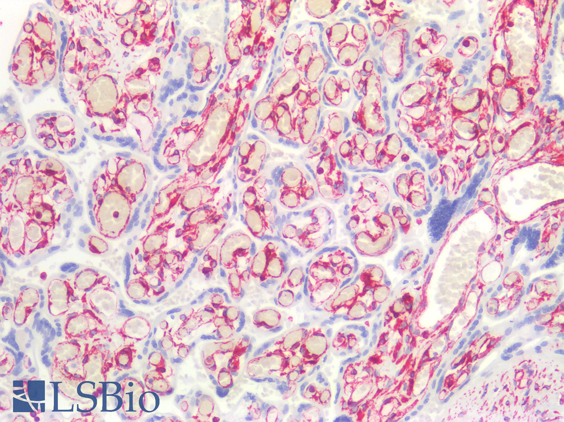Vimentin Antibody - Human Placenta: Formalin-Fixed, Paraffin-Embedded (FFPE)