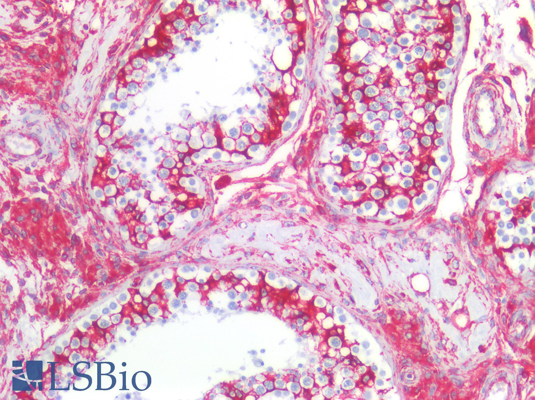 Vimentin Antibody - Human Testis: Formalin-Fixed, Paraffin-Embedded (FFPE)