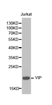 VIP Antibody - Western blot analysis of extracts of Jurkat cell lines, using VIP antibody.