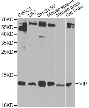 VIP Antibody - Western blot analysis of extracts of various cell lines, using VIP antibody at 1:1000 dilution. The secondary antibody used was an HRP Goat Anti-Rabbit IgG (H+L) at 1:10000 dilution. Lysates were loaded 25ug per lane and 3% nonfat dry milk in TBST was used for blocking. An ECL Kit was used for detection and the exposure time was 60s.