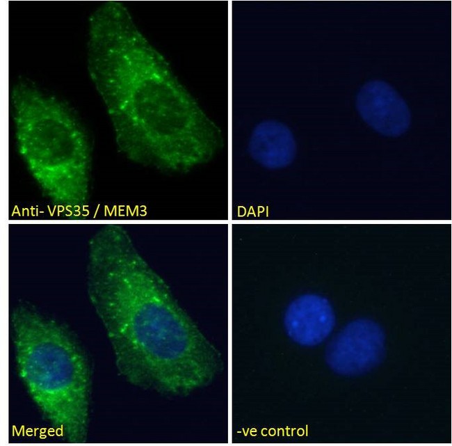 VPS35 Antibody - VPS35 / MEM3 antibody immunofluorescence analysis of paraformaldehyde fixed U2OS cells, permeabilized with 0.15% Triton. Primary incubation 1hr (10ug/ml) followed by Alexa Fluor 488 secondary antibody (2ug/ml), showing cytoplasmic staining. The nuclear stain is DAPI (blue). Negative control: Unimmunized goat IgG (10ug/ml) followed by Alexa Fluor 488 secondary antibody (2ug/ml).