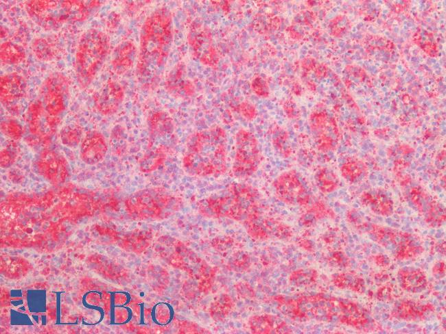 VPS37A Antibody - Human Spleen: Formalin-Fixed, Paraffin-Embedded (FFPE)