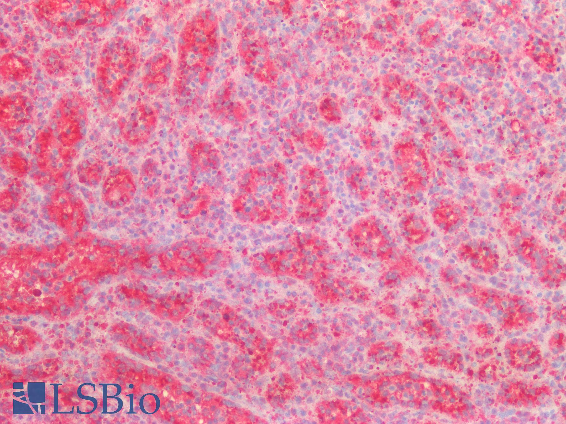 VPS37A Antibody - Human Spleen: Formalin-Fixed, Paraffin-Embedded (FFPE)