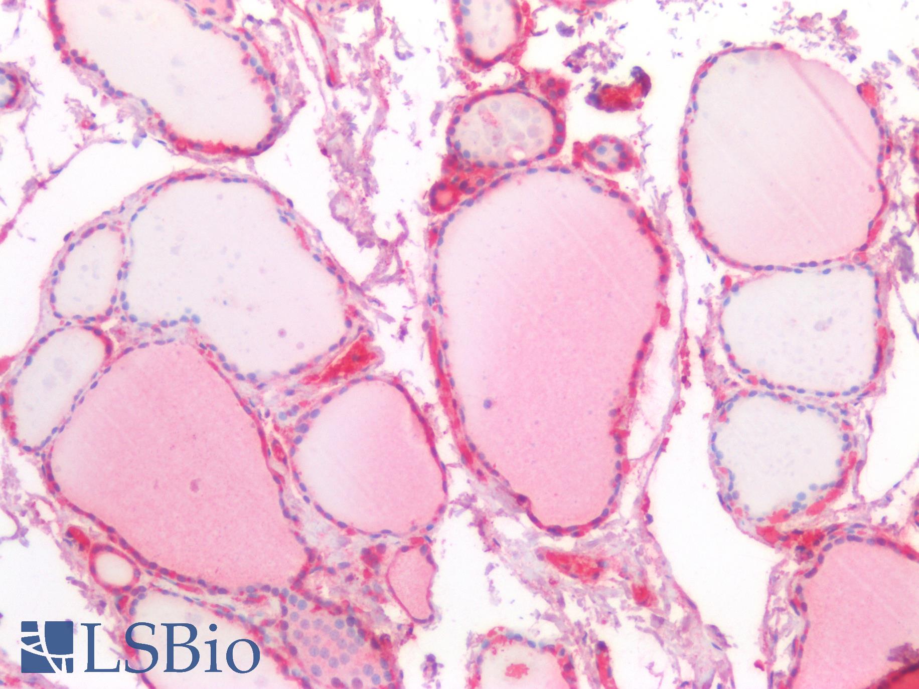 VPS37A Antibody - Human Thyroid: Formalin-Fixed, Paraffin-Embedded (FFPE)