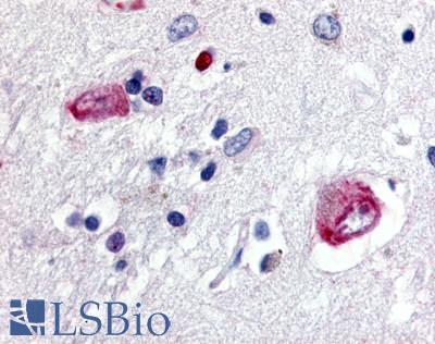 WNT8A Antibody - Brain, Caudate, neurons and glia