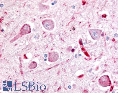 WNT8A Antibody - Brain, Thalamus, neurons and glia