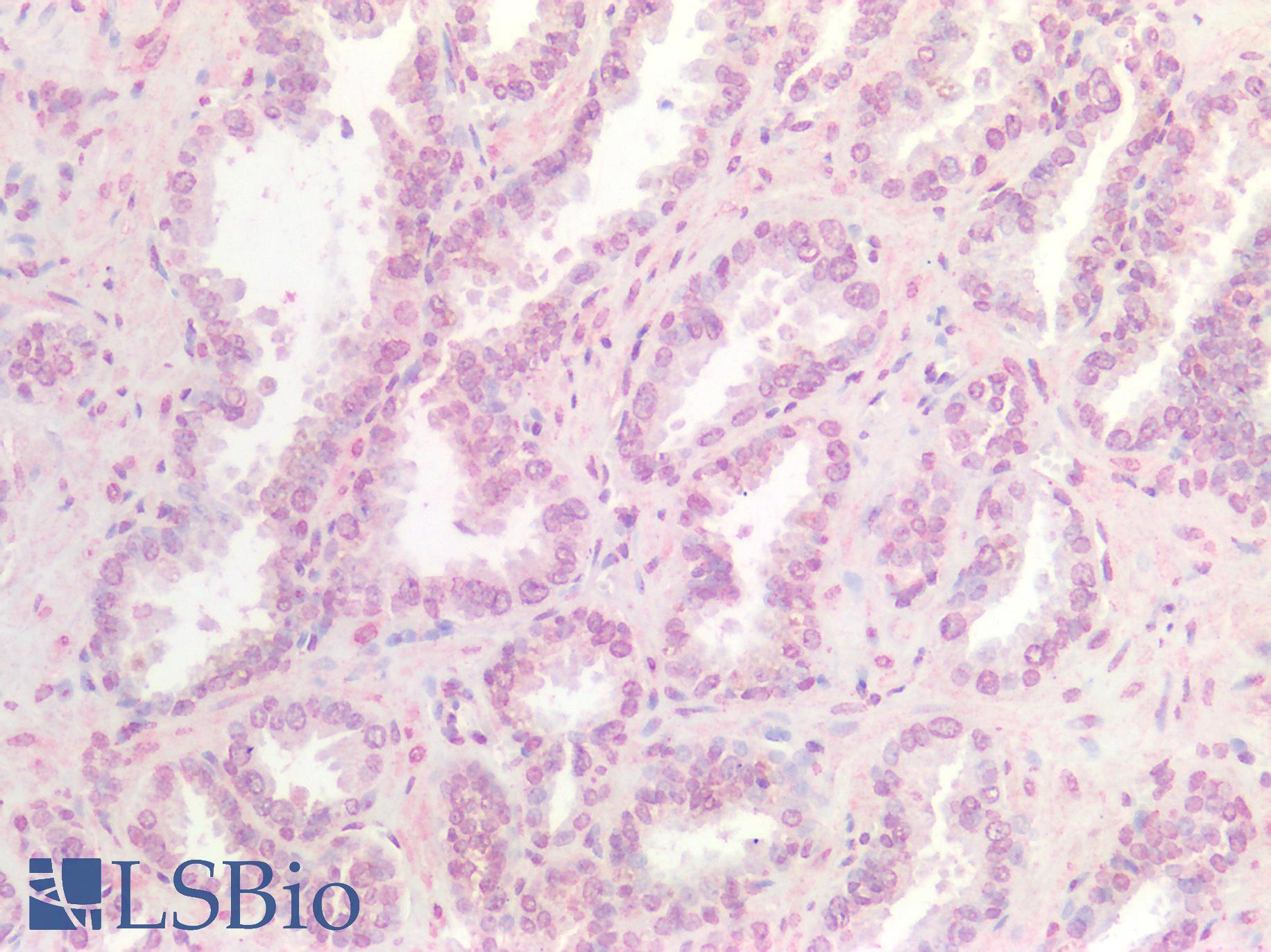WNT9B / WNT15 Antibody - Human Prostate: Formalin-Fixed, Paraffin-Embedded (FFPE)