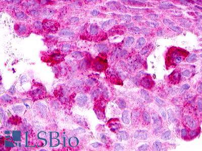 XCR1 Antibody - Ovary, carcinoma