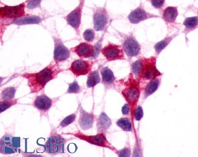 XPR1 Antibody - Anti-XPR1 antibody immunocytochemistry (ICC) staining of HEK293 human embryonic kidney cells transfected with XPR1.