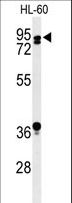 PATL1 Antibody - Western blot of PATL1 Antibody in HL-60 cell line lysates (35 ug/lane). PATL1 (arrow) was detected using the purified antibody.