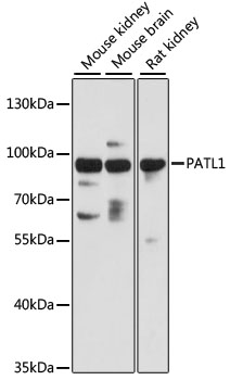 PATL1 Antibody - Western blot analysis of extracts of various cell lines, using PATL1 antibody at 1:3000 dilution. The secondary antibody used was an HRP Goat Anti-Rabbit IgG (H+L) at 1:10000 dilution. Lysates were loaded 25ug per lane and 3% nonfat dry milk in TBST was used for blocking. An ECL Kit was used for detection and the exposure time was 30s.