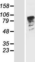 PATL1 Protein - Western validation with an anti-DDK antibody * L: Control HEK293 lysate R: Over-expression lysate