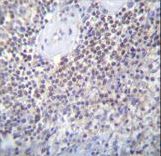 PATL2 Antibody - PATL2 Antibody immunohistochemistry of formalin-fixed and paraffin-embedded human spleen tissue followed by peroxidase-conjugated secondary antibody and DAB staining.