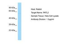 PATL2 Antibody -  This image was taken for the unconjugated form of this product. Other forms have not been tested.