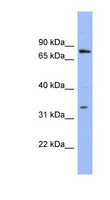 PATZ1 / PATZ Antibody - PATZ1 antibody Western blot of OVCAR-3 cell lysate. This image was taken for the unconjugated form of this product. Other forms have not been tested.