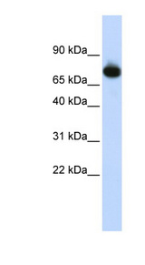 PATZ1 / PATZ Antibody - PATZ1 antibody Western blot of HepG2 cell lysate. This image was taken for the unconjugated form of this product. Other forms have not been tested.