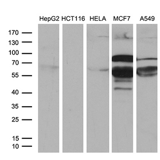 PATZ1 / PATZ Antibody - Western blot analysis of extracts. (35ug) from 5 different cell lines by using anti-PATZ1 monoclonal antibody. (1:500)