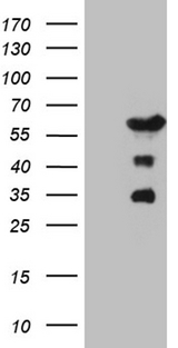 PATZ1 / PATZ Antibody - HEK293T cells were transfected with the pCMV6-ENTRY control. (Left lane) or pCMV6-ENTRY PATZ1. (Right lane) cDNA for 48 hrs and lysed