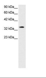 PAWR / PAR4 Antibody - Jurkat Cell Lysate.  This image was taken for the unconjugated form of this product. Other forms have not been tested.