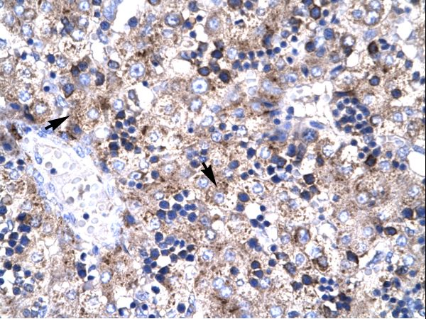 PAWR / PAR4 Antibody - PAWR / PAR4 antibody ARP32735_T100-NP_002574-PAWR (PRKC, apoptosis, WT1, regulator) Antibody was used in IHC to stain formalin-fixed, paraffin-embedded human liver.  This image was taken for the unconjugated form of this product. Other forms have not been tested.