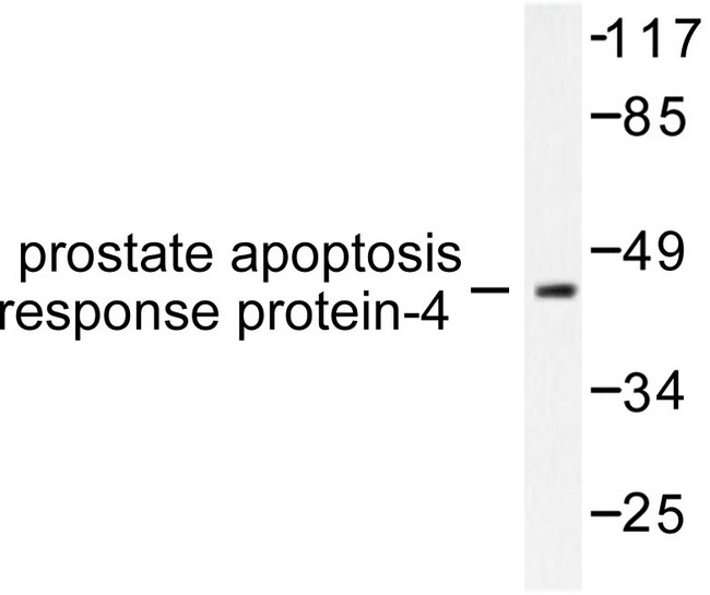 PAWR / PAR4 Antibody - Western blot of Prostate Apoptosis Response protein-4 (D313) pAb in extracts from NIH/3T3 cells.