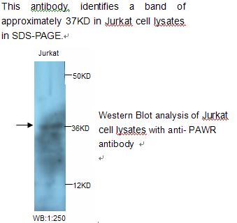 PAWR / PAR4 Antibody