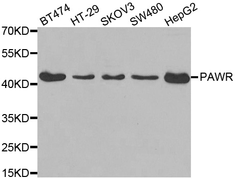 PAWR / PAR4 Antibody - Western blot analysis of extracts of various cell lines.