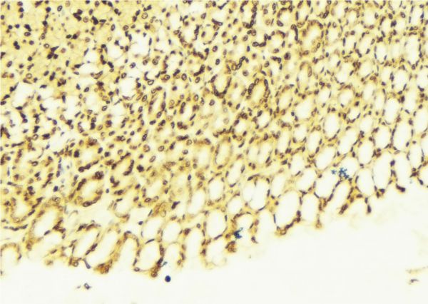 PAWR / PAR4 Antibody - 1:100 staining human gastric tissue by IHC-P. The sample was formaldehyde fixed and a heat mediated antigen retrieval step in citrate buffer was performed. The sample was then blocked and incubated with the antibody for 1.5 hours at 22°C. An HRP conjugated goat anti-rabbit antibody was used as the secondary.