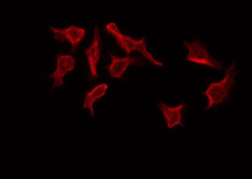 PAWR / PAR4 Antibody - Staining NIH-3T3 cells by IF/ICC. The samples were fixed with PFA and permeabilized in 0.1% Triton X-100, then blocked in 10% serum for 45 min at 25°C. The primary antibody was diluted at 1:200 and incubated with the sample for 1 hour at 37°C. An Alexa Fluor 594 conjugated goat anti-rabbit IgG (H+L) Ab, diluted at 1/600, was used as the secondary antibody.