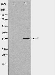 PAWR / PAR4 Antibody - Western blot analysis of A549 whole cells lysates using PAWR antibody. The lane on the left is treated with the antigen-specific peptide.