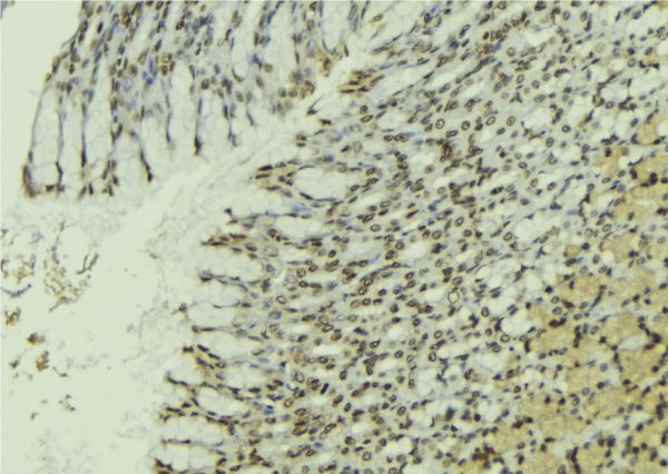 PAWR / PAR4 Antibody - 1:100 staining human gastric tissue by IHC-P. The sample was formaldehyde fixed and a heat mediated antigen retrieval step in citrate buffer was performed. The sample was then blocked and incubated with the antibody for 1.5 hours at 22°C. An HRP conjugated goat anti-rabbit antibody was used as the secondary.