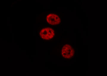 PAWR / PAR4 Antibody - Staining NIH-3T3 cells by IF/ICC. The samples were fixed with PFA and permeabilized in 0.1% Triton X-100, then blocked in 10% serum for 45 min at 25°C. The primary antibody was diluted at 1:200 and incubated with the sample for 1 hour at 37°C. An Alexa Fluor 594 conjugated goat anti-rabbit IgG (H+L) antibody, diluted at 1/600, was used as secondary antibody.