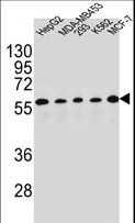 PAX1 Antibody - PAX1 Antibody western blot of HepG2,MDA-MB453,293,K562,MCF-7 cell line lysates (35 ug/lane). The PAX1 antibody detected the PAX1 protein (arrow).