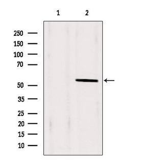 PAX1 Antibody - Western blot analysis of extracts of HeLa cells using PAX1 antibody. Lane 1 was treated with the blocking peptide.