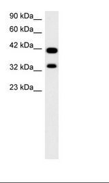 PAX2 Antibody - Fetal Kidney Lysate.  This image was taken for the unconjugated form of this product. Other forms have not been tested.