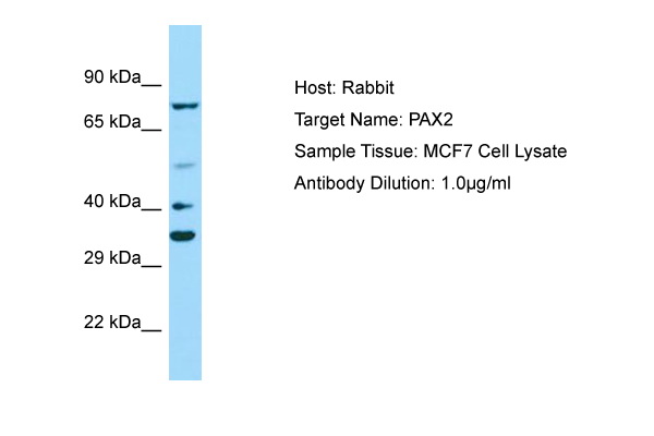 PAX2 Antibody -  This image was taken for the unconjugated form of this product. Other forms have not been tested.